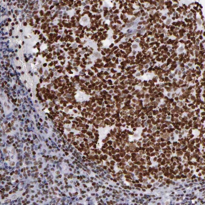 TRF-2 Antibody - BSA Free Immunohistochemistry-Paraffin: TRF-2 Antibody - BSA Free [NBP1-86911]