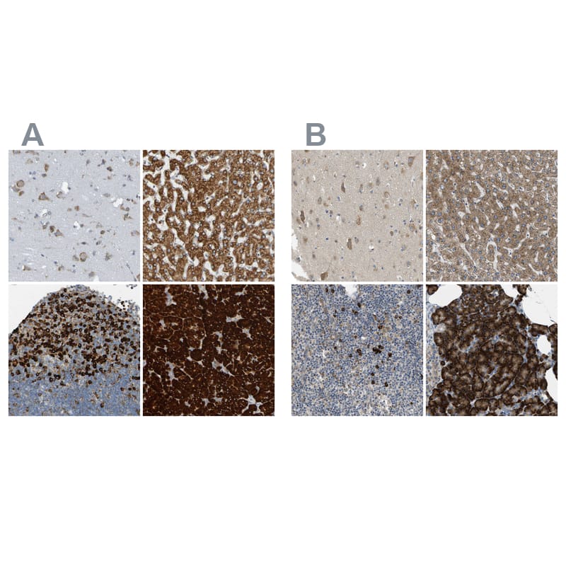 TRAP alpha Antibody - BSA Free Immunohistochemistry-Paraffin: TRAP alpha Antibody - BSA Free [NBP1-86912]