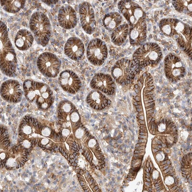 Two pore calcium channel protein 2 Antibody - BSA Free Immunohistochemistry-Paraffin: Two pore calcium channel protein 2 Antibody - BSA Free [NBP1-86923]