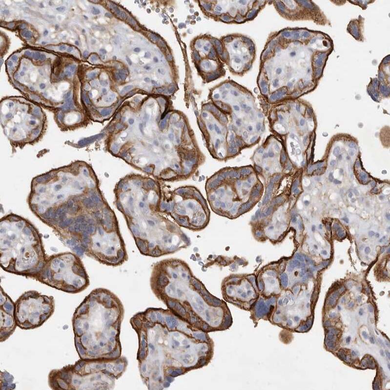 Two pore calcium channel protein 2 Antibody - BSA Free Immunohistochemistry-Paraffin: Two pore calcium channel protein 2 Antibody - BSA Free [NBP1-86923]