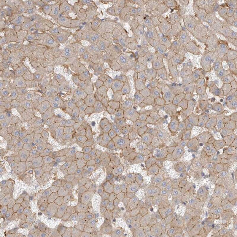 Two pore calcium channel protein 2 Antibody - BSA Free Immunohistochemistry-Paraffin: Two pore calcium channel protein 2 Antibody - BSA Free [NBP1-86923]