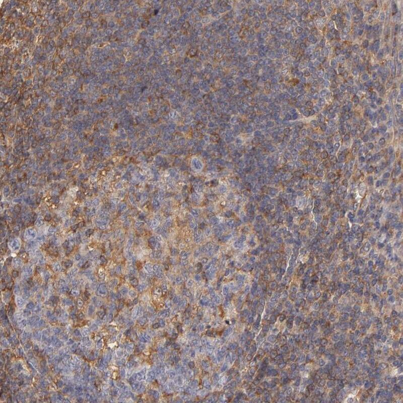 FAIM3 Antibody - BSA Free Immunohistochemistry-Paraffin: FAIM3 Antibody - BSA Free [NBP1-86924]