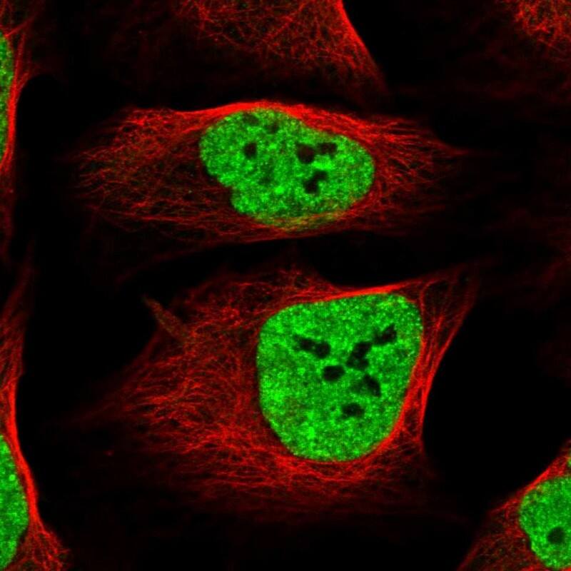 TORC2 Antibody - BSA Free Immunocytochemistry/ Immunofluorescence: TORC2 Antibody [NBP1-86925]