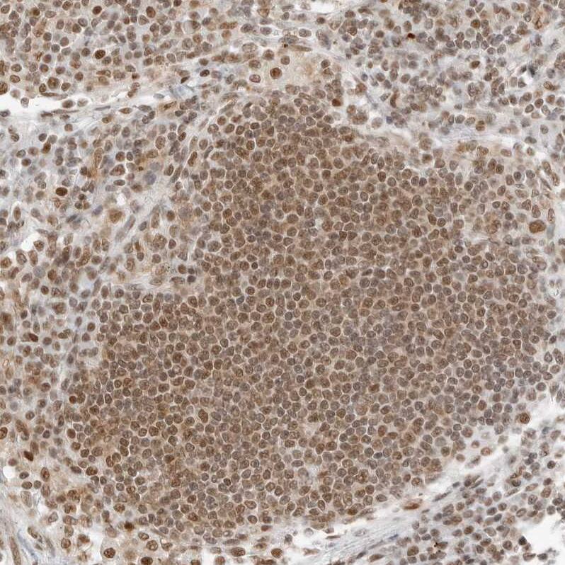 TORC2 Antibody - BSA Free Immunohistochemistry-Paraffin: TORC2 Antibody - BSA Free [NBP1-86925]