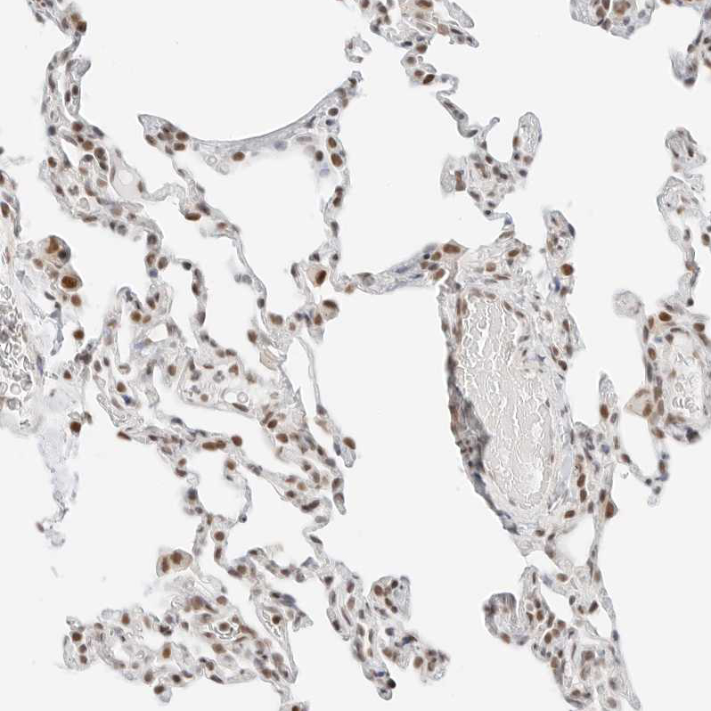 TORC2 Antibody - BSA Free Immunohistochemistry-Paraffin: TORC2 Antibody - BSA Free [NBP1-86925]