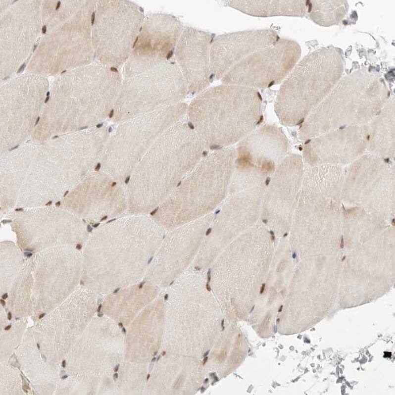 TORC2 Antibody - BSA Free Immunohistochemistry-Paraffin: TORC2 Antibody - BSA Free [NBP1-86925]