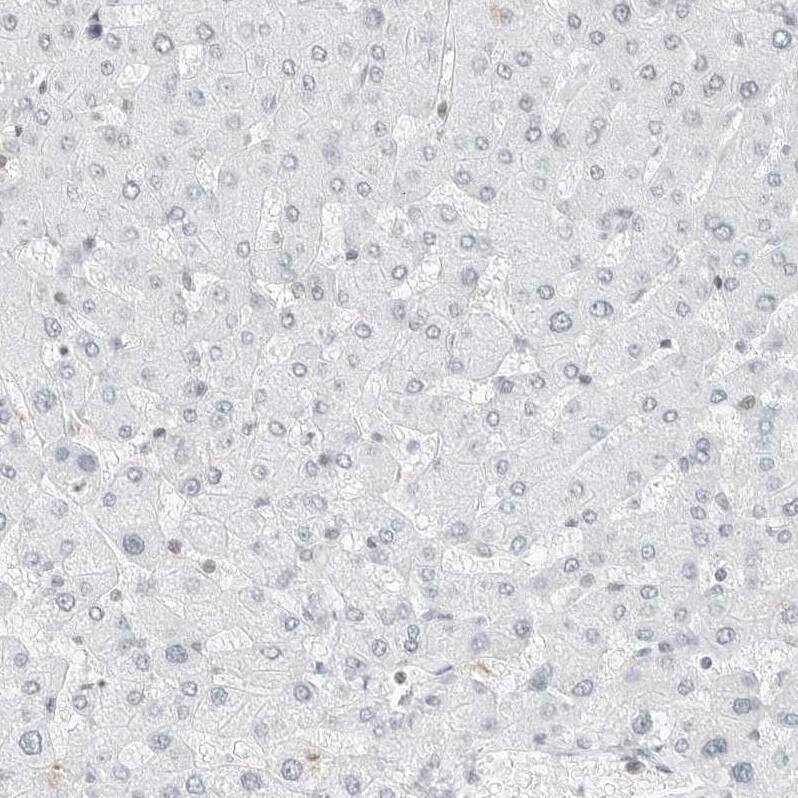 TORC2 Antibody - BSA Free Immunohistochemistry-Paraffin: TORC2 Antibody - BSA Free [NBP1-86925]