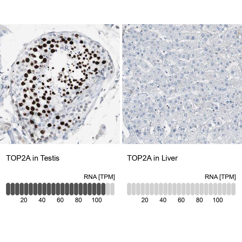 TOP2A Antibody - BSA Free Immunohistochemistry-Paraffin: TOP2A Antibody - BSA Free [NBP1-86928]