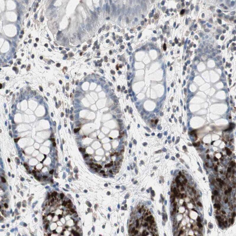 TOP2A Antibody - BSA Free Immunohistochemistry-Paraffin: TOP2A Antibody - BSA Free [NBP1-86928]