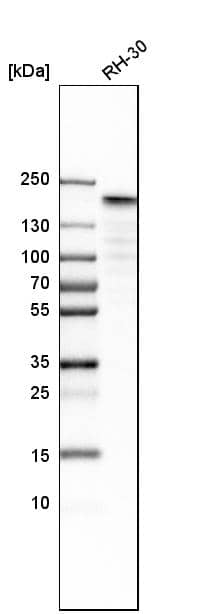 TOP2A Antibody - BSA Free Western Blot: TOP2A Antibody - BSA Free [NBP1-86928]