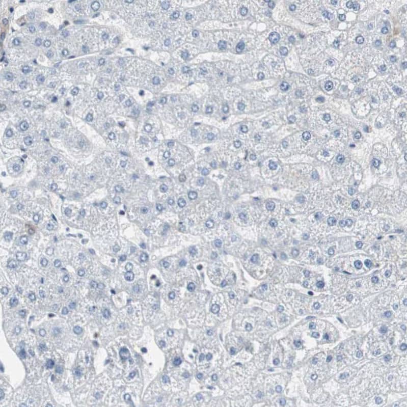 TOP2A Antibody - BSA Free Immunohistochemistry-Paraffin: TOP2A Antibody - BSA Free [NBP1-86928]