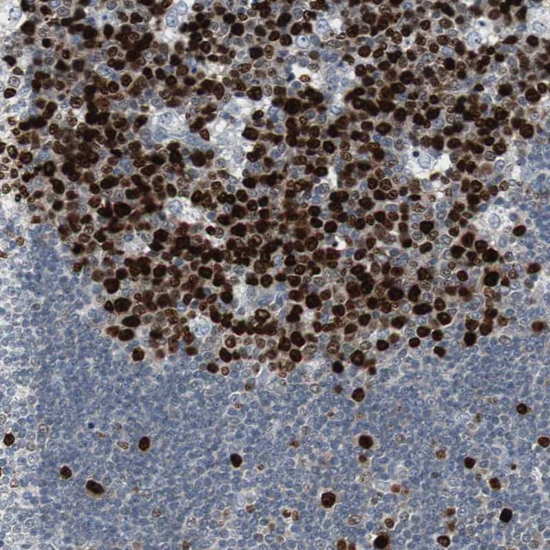 TOP2A Antibody - BSA Free Immunohistochemistry-Paraffin: TOP2A Antibody - BSA Free [NBP1-86928]