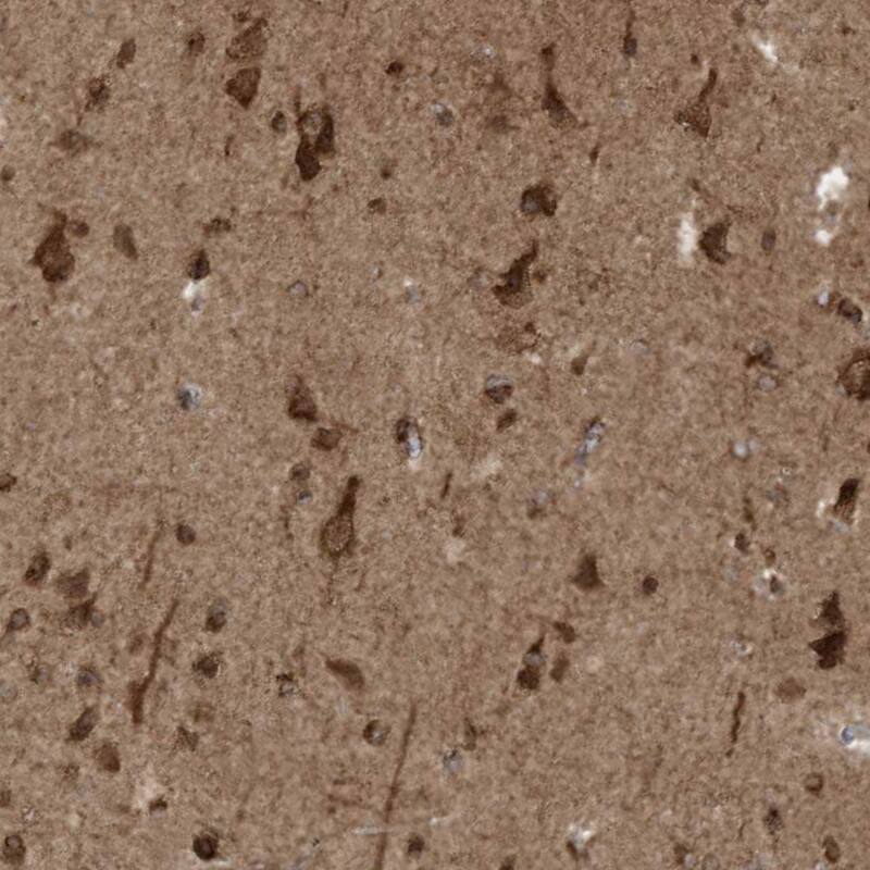 TRIM67 Antibody - BSA Free Immunohistochemistry-Paraffin: TRIM67 Antibody - BSA Free [NBP1-86929]