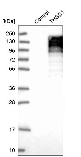 THSD1 Antibody - BSA Free Western Blot: THSD1 Antibody - BSA Free [NBP1-86930]