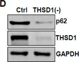 THSD1 Antibody - BSA Free