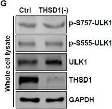 THSD1 Antibody - BSA Free