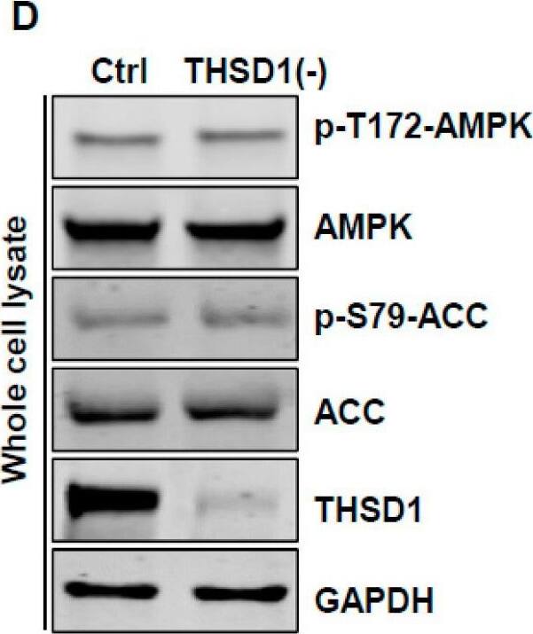 THSD1 Antibody - BSA Free