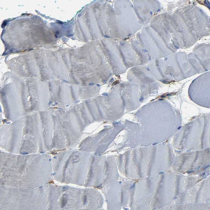 CD97 Antibody - BSA Free Immunohistochemistry-Paraffin: CD97 Antibody - BSA Free [NBP1-86935]