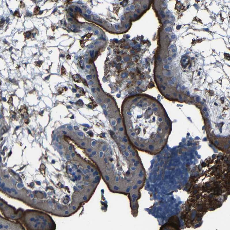 CD97 Antibody - BSA Free Immunohistochemistry-Paraffin: CD97 Antibody - BSA Free [NBP1-86935]