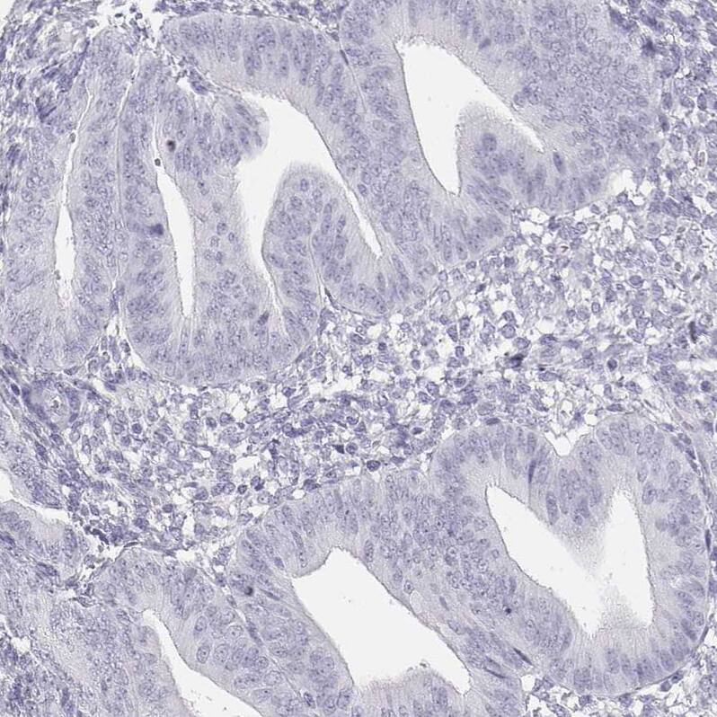 TKTL1 Antibody - BSA Free Immunohistochemistry-Paraffin: TKTL1 Antibody - BSA Free [NBP1-86939]
