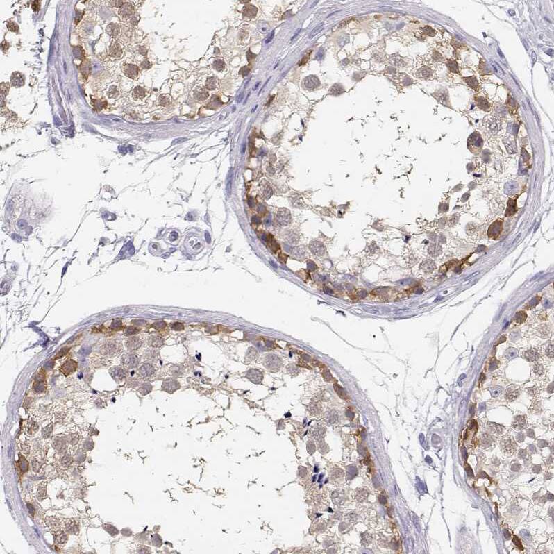 TKTL1 Antibody - BSA Free Immunohistochemistry-Paraffin: TKTL1 Antibody - BSA Free [NBP1-86939]