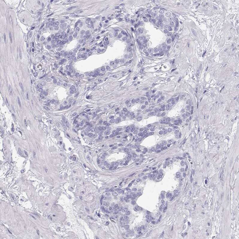 TKTL1 Antibody - BSA Free Immunohistochemistry-Paraffin: TKTL1 Antibody - BSA Free [NBP1-86939]