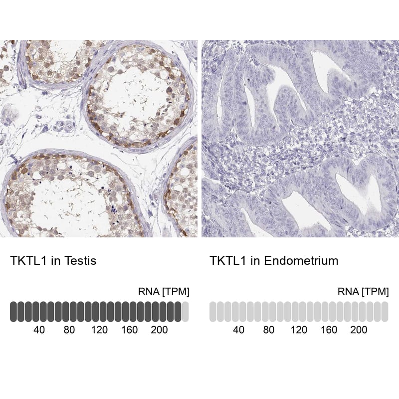 TKTL1 Antibody - BSA Free Immunohistochemistry-Paraffin: TKTL1 Antibody - BSA Free [NBP1-86939]