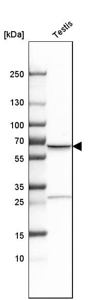 TKTL1 Antibody - BSA Free Western Blot: TKTL1 Antibody - BSA Free [NBP1-86939]