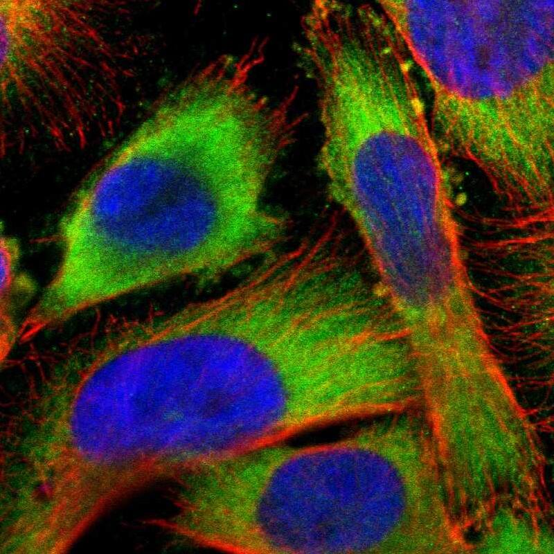 USP14 Antibody - BSA Free Immunocytochemistry/ Immunofluorescence: USP14 Antibody [NBP1-86946]