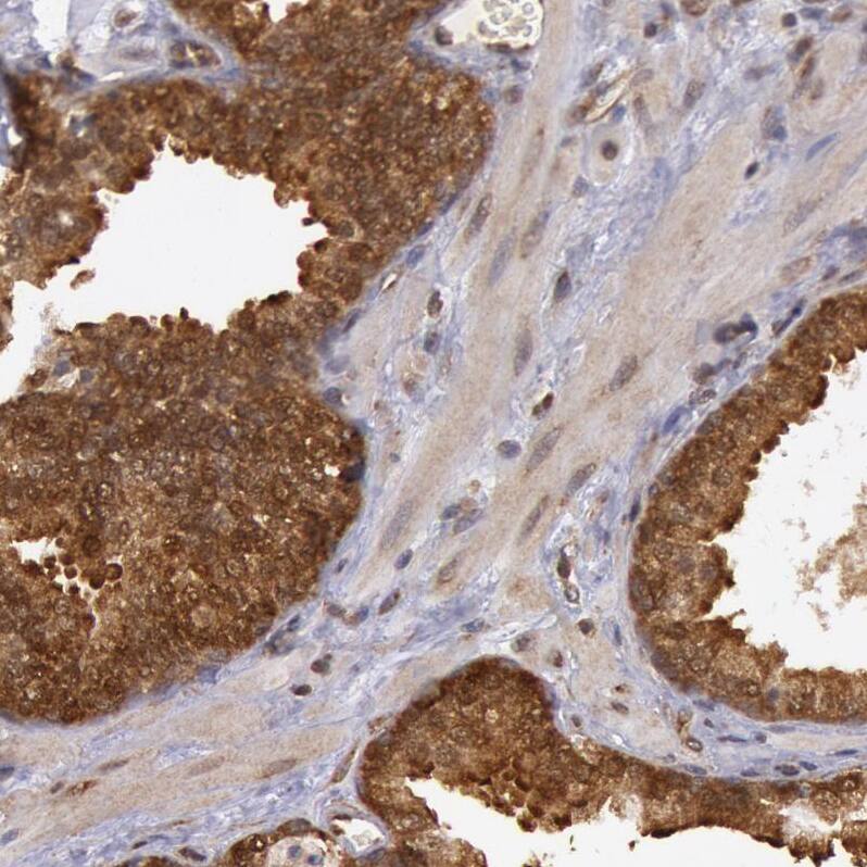 USP14 Antibody - BSA Free Immunohistochemistry-Paraffin: USP14 Antibody - BSA Free [NBP1-86946]