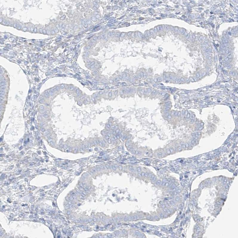 Transglutaminase 4/TGM4 Antibody - BSA Free Immunohistochemistry-Paraffin: Transglutaminase 4/TGM4 Antibody [NBP1-86947]