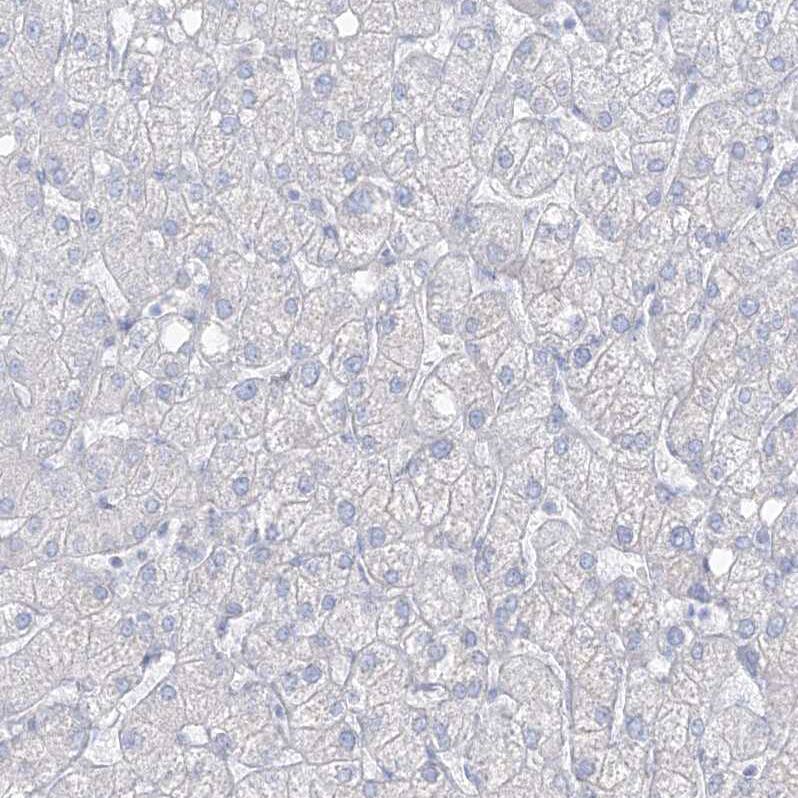 Transglutaminase 4/TGM4 Antibody - BSA Free Immunohistochemistry-Paraffin: Transglutaminase 4/TGM4 Antibody [NBP1-86947]