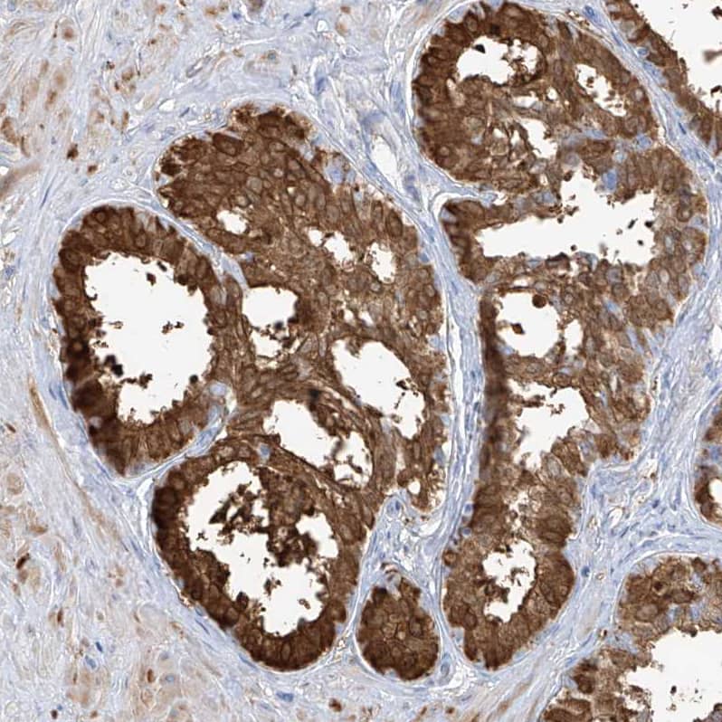 Transglutaminase 4/TGM4 Antibody - BSA Free Immunohistochemistry-Paraffin: Transglutaminase 4/TGM4 Antibody [NBP1-86947]
