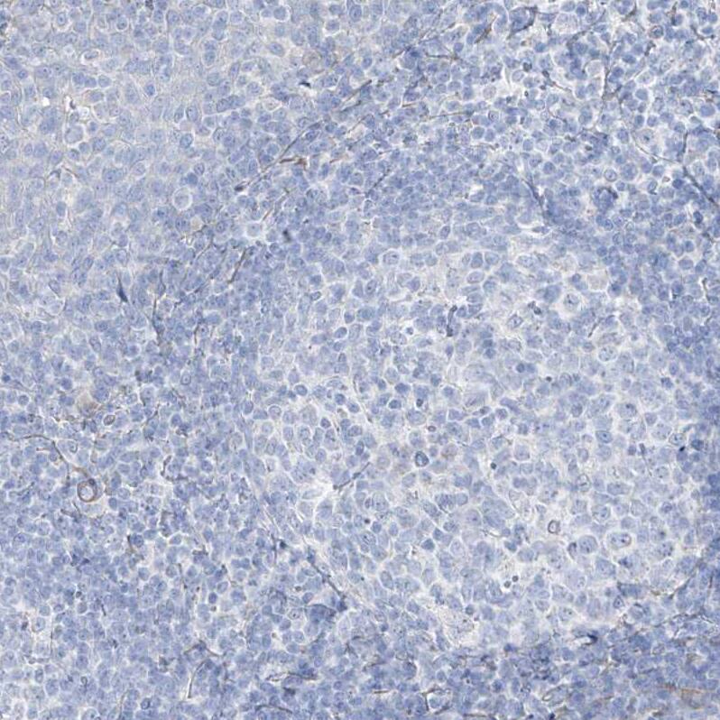 Transglutaminase 4/TGM4 Antibody - BSA Free Immunohistochemistry-Paraffin: Transglutaminase 4/TGM4 Antibody [NBP1-86947]