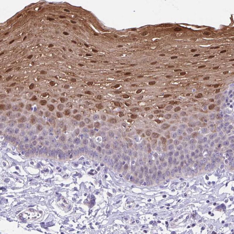 Transglutaminase 3/TGM3 Antibody - BSA Free Immunohistochemistry-Paraffin: Transglutaminase 3/TGM3 Antibody - BSA Free [NBP1-86950]