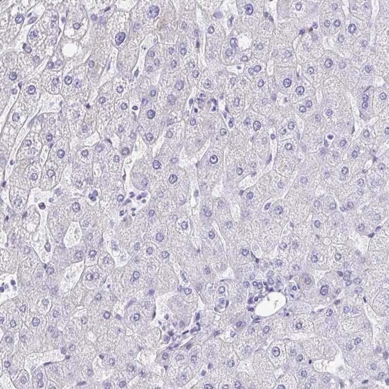 Transglutaminase 3/TGM3 Antibody - BSA Free Immunohistochemistry-Paraffin: Transglutaminase 3/TGM3 Antibody - BSA Free [NBP1-86950]