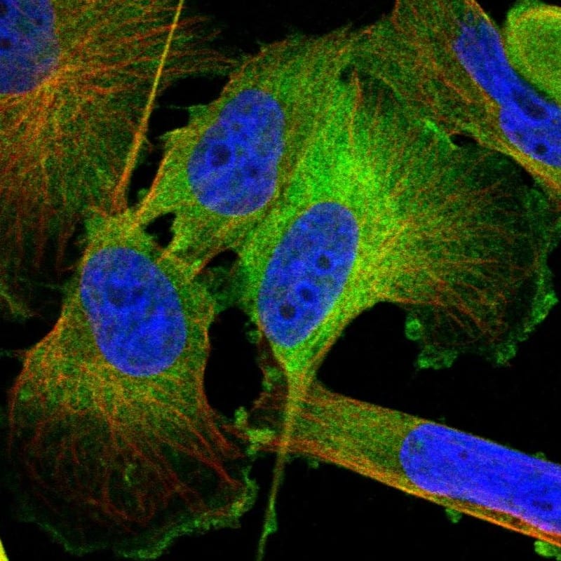 Transglutaminase 2/TGM2 Antibody - BSA Free Immunocytochemistry/ Immunofluorescence: Transglutaminase 2/TGM2 Antibody [NBP1-86951]