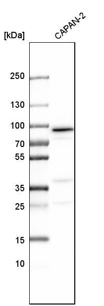 Transglutaminase 2/TGM2 Antibody - BSA Free Western Blot: Transglutaminase 2/TGM2 Antibody - BSA Free [NBP1-86952]