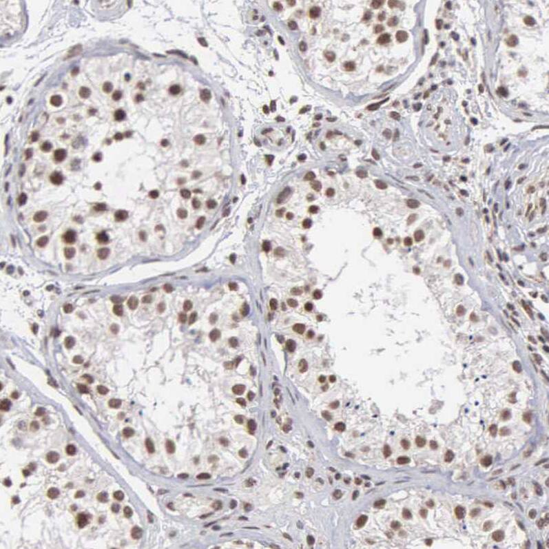 GTF2A1 Antibody - BSA Free Immunohistochemistry-Paraffin: GTF2A1 Antibody - BSA Free [NBP1-86953]