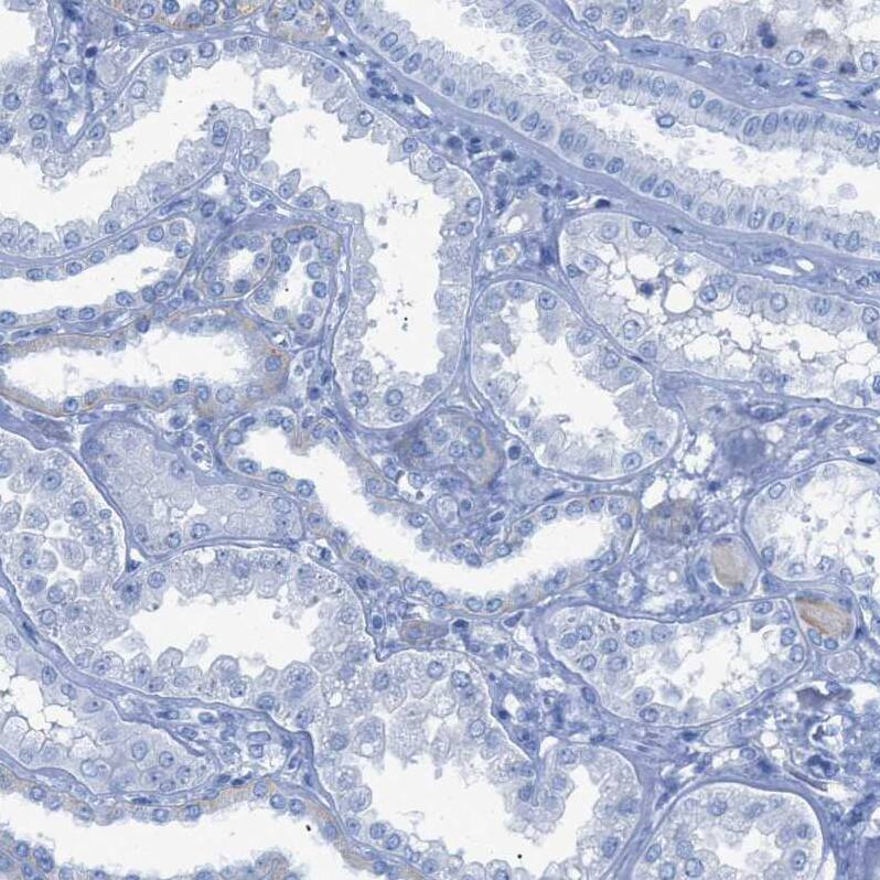 TCL1A Antibody Immunohistochemistry-Paraffin: TCL1A Antibody [NBP1-86958]