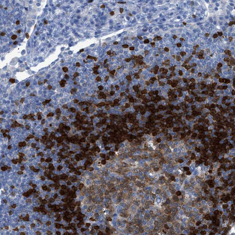 TCL1A Antibody Immunohistochemistry-Paraffin: TCL1A Antibody [NBP1-86958]