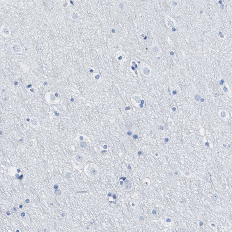 TCL1A Antibody Immunohistochemistry-Paraffin: TCL1A Antibody [NBP1-86958]