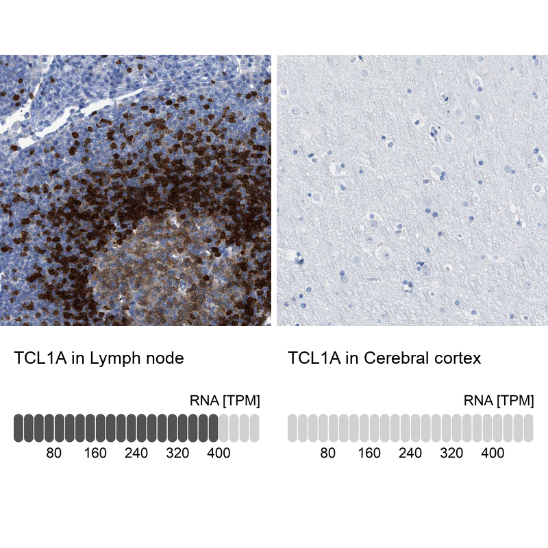 TCL1A Antibody Immunohistochemistry-Paraffin: TCL1A Antibody [NBP1-86958]