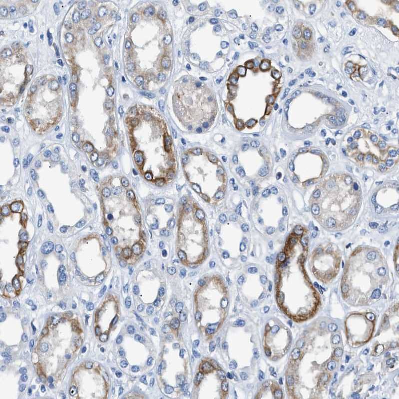 TauT/SLC6A6 Antibody - BSA Free Immunohistochemistry-Paraffin: TauT/SLC6A6 Antibody - BSA Free [NBP1-86964]