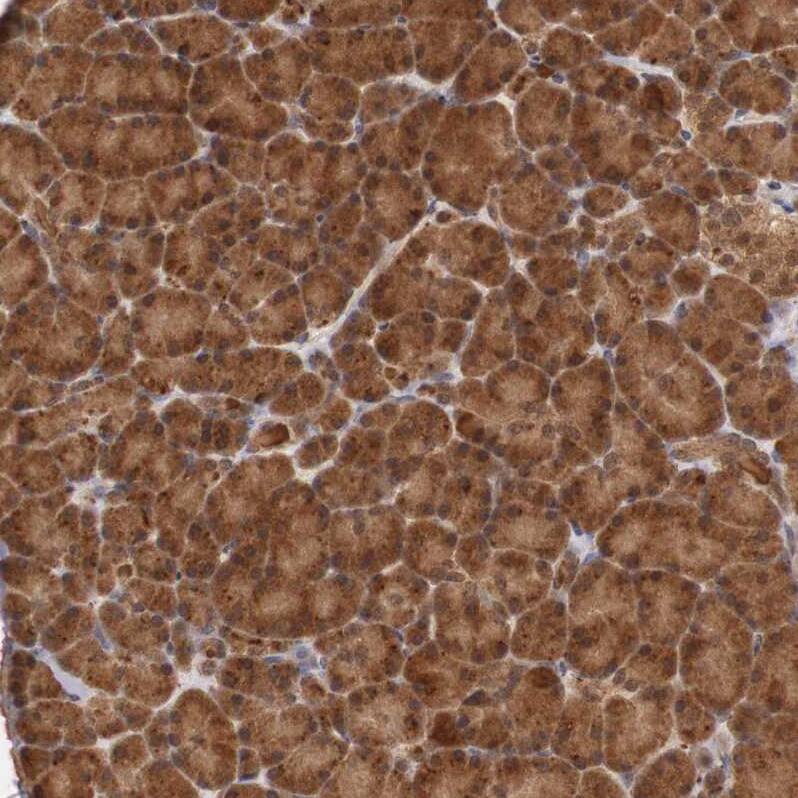 TAPP1/PLEKHA1 Antibody - BSA Free Immunohistochemistry-Paraffin: TAPP1/PLEKHA1 Antibody - BSA Free [NBP1-86967]