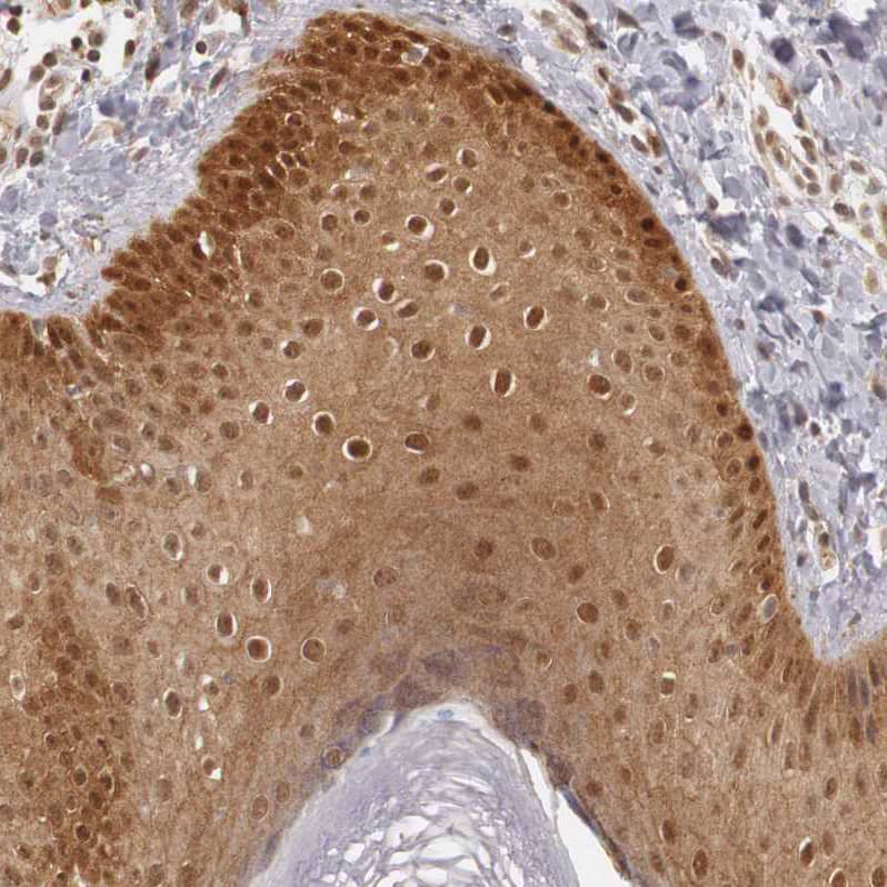 TAPP1/PLEKHA1 Antibody - BSA Free Immunohistochemistry-Paraffin: TAPP1/PLEKHA1 Antibody - BSA Free [NBP1-86967]