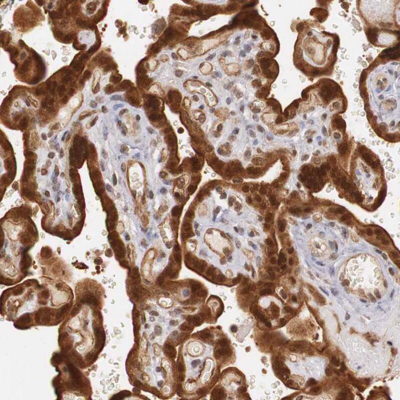 TAPP1/PLEKHA1 Antibody - BSA Free Immunohistochemistry-Paraffin: TAPP1/PLEKHA1 Antibody - BSA Free [NBP1-86967]