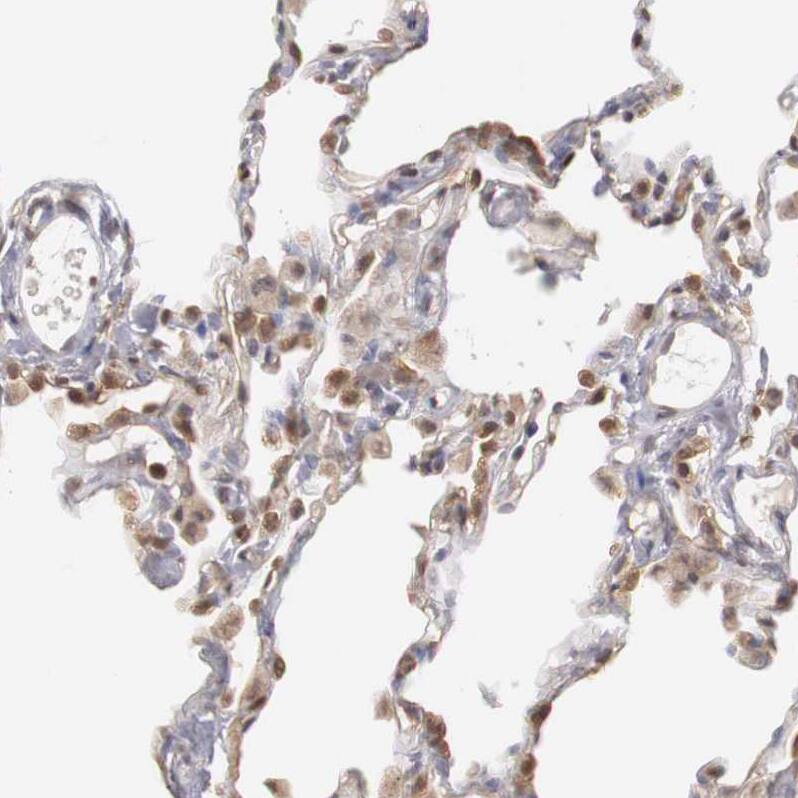 TAPP1/PLEKHA1 Antibody - BSA Free Immunohistochemistry-Paraffin: TAPP1/PLEKHA1 Antibody - BSA Free [NBP1-86967]