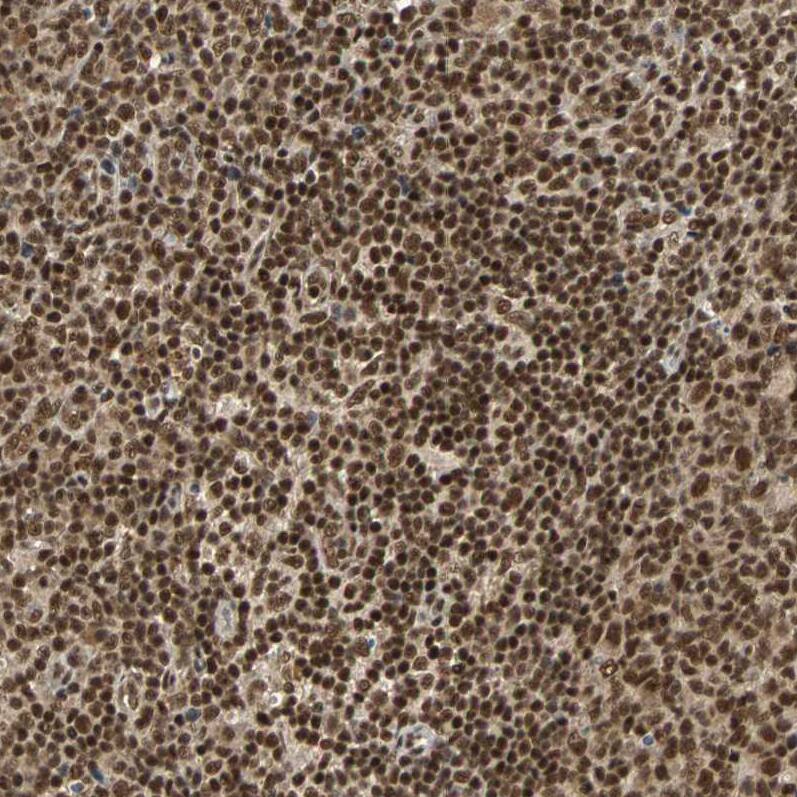 TAF5 Antibody - BSA Free Immunohistochemistry-Paraffin: TAF5 Antibody - BSA Free [NBP1-86970]