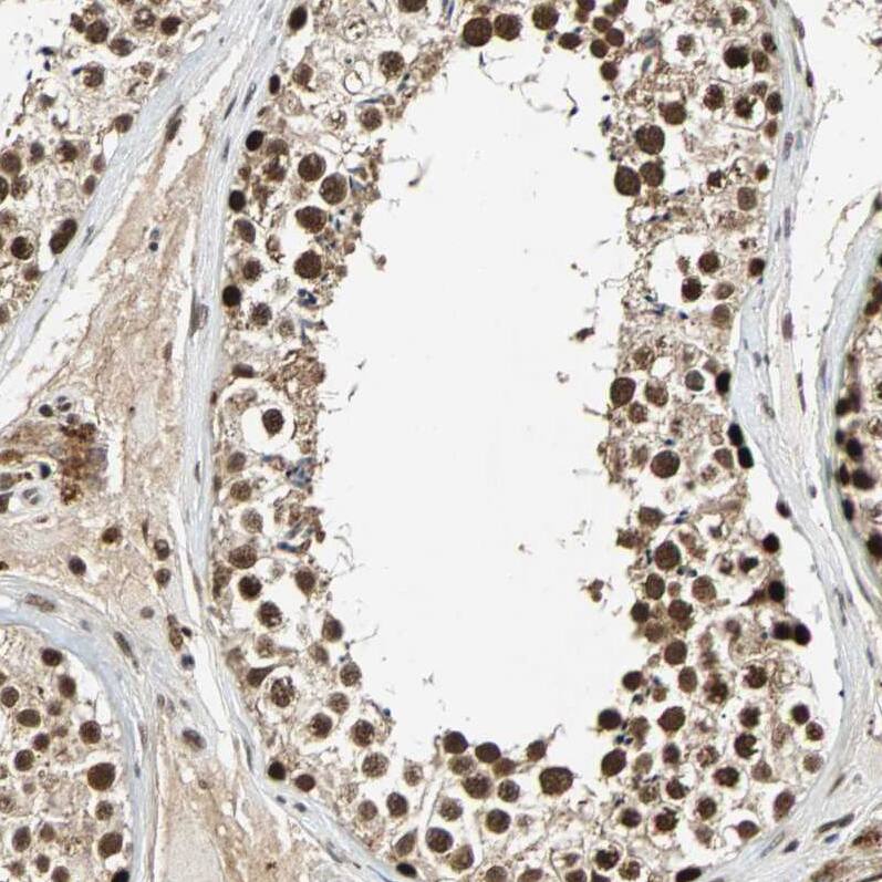 TAF5 Antibody - BSA Free Immunohistochemistry-Paraffin: TAF5 Antibody - BSA Free [NBP1-86970]